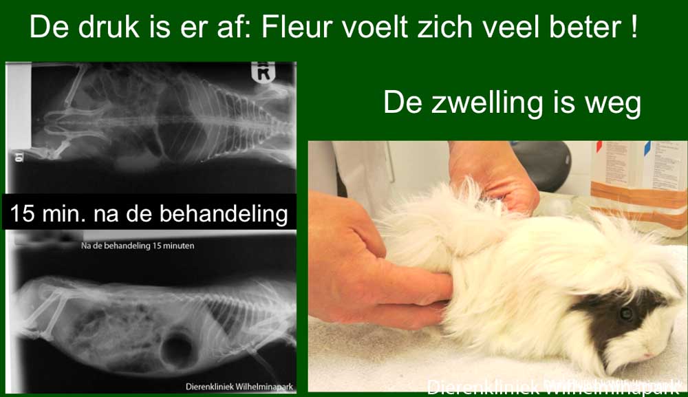 De buikholte van Fleur is na de behandeling veel minder opgezet
